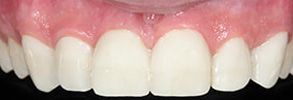 94523 Dental Photos